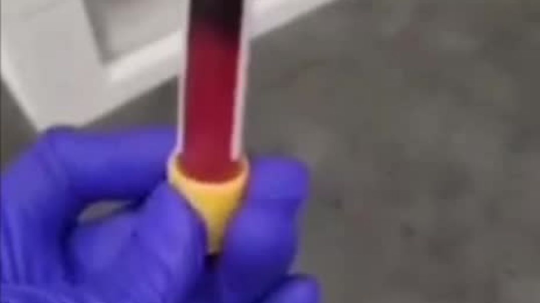 ⁣⁣Blutprobe - Dieses Blut wurde einer geimpften Patientin entnommen. Nach drei Minuten sah sie so aus