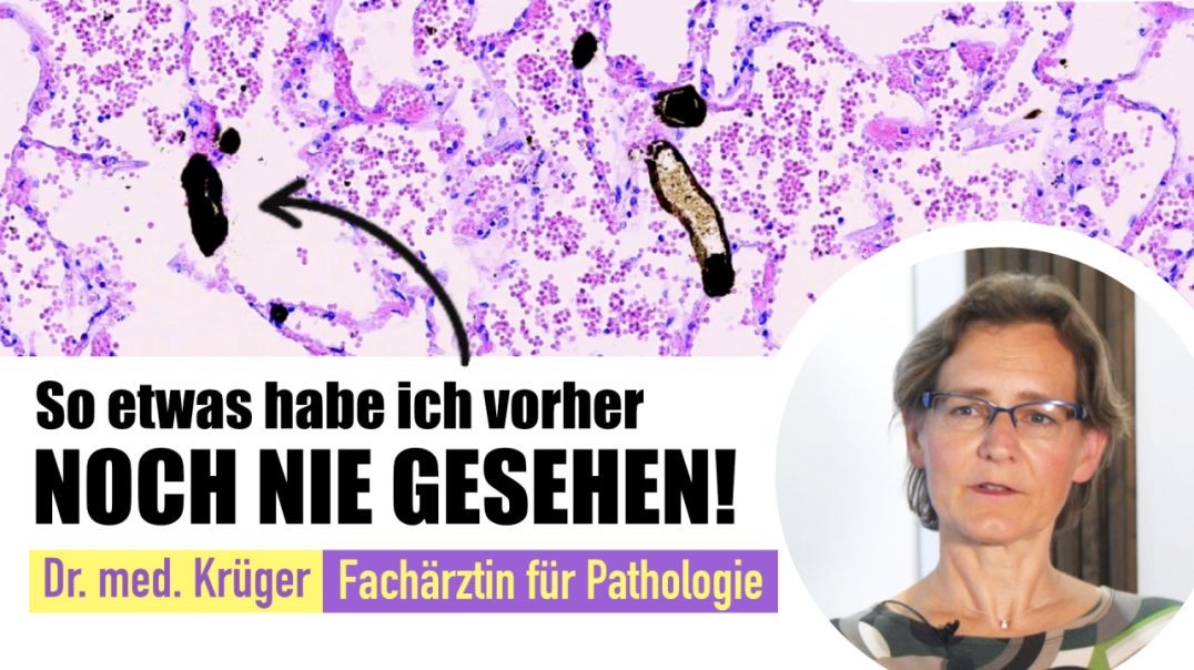 ⁣mRNA Corona Impfungen - Ursache von Krankheiten und Tod